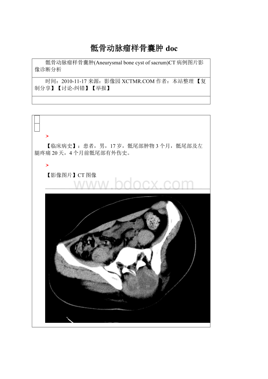 骶骨动脉瘤样骨囊肿doc.docx_第1页