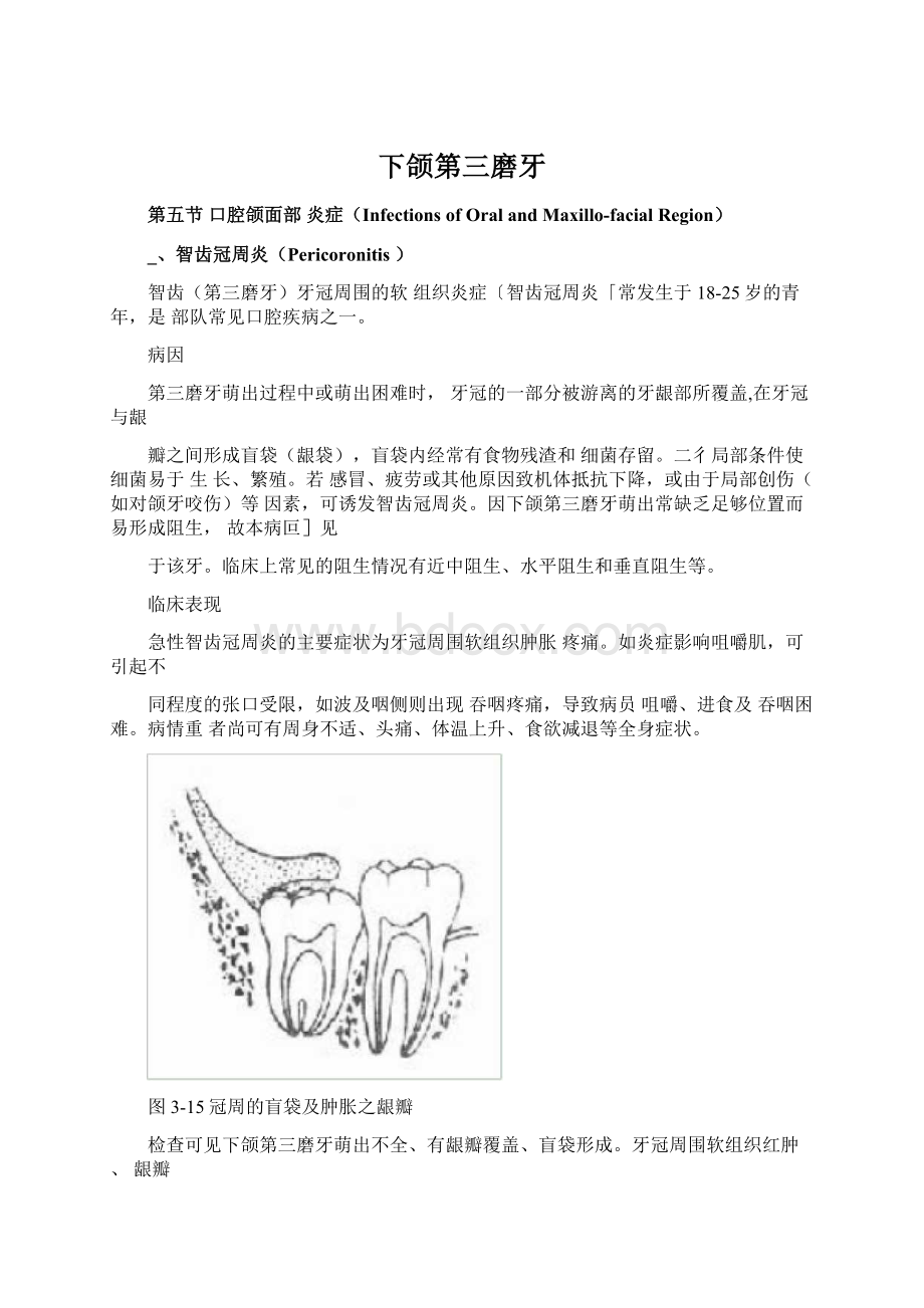 下颌第三磨牙.docx_第1页