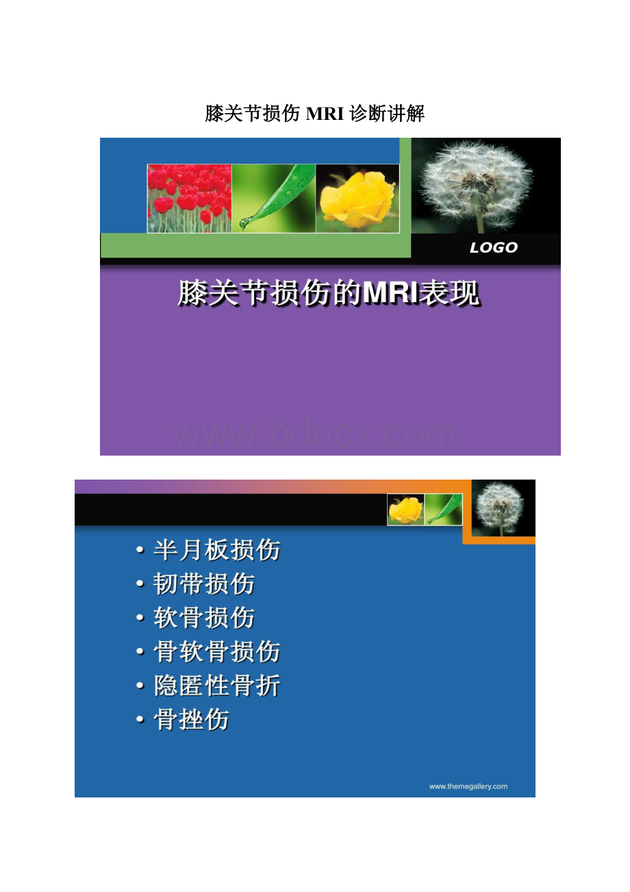 膝关节损伤MRI诊断讲解Word文件下载.docx