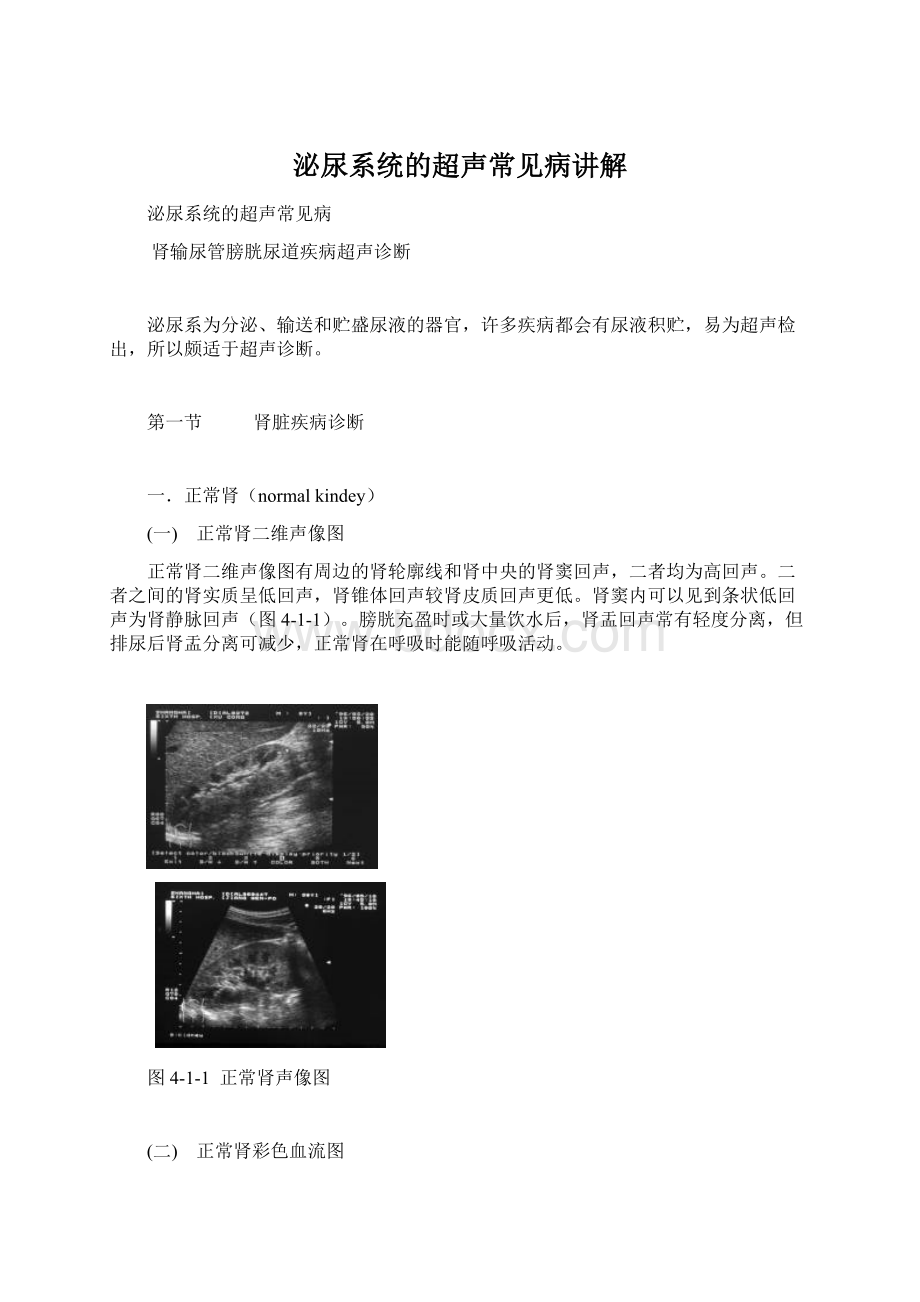 泌尿系统的超声常见病讲解Word格式文档下载.docx