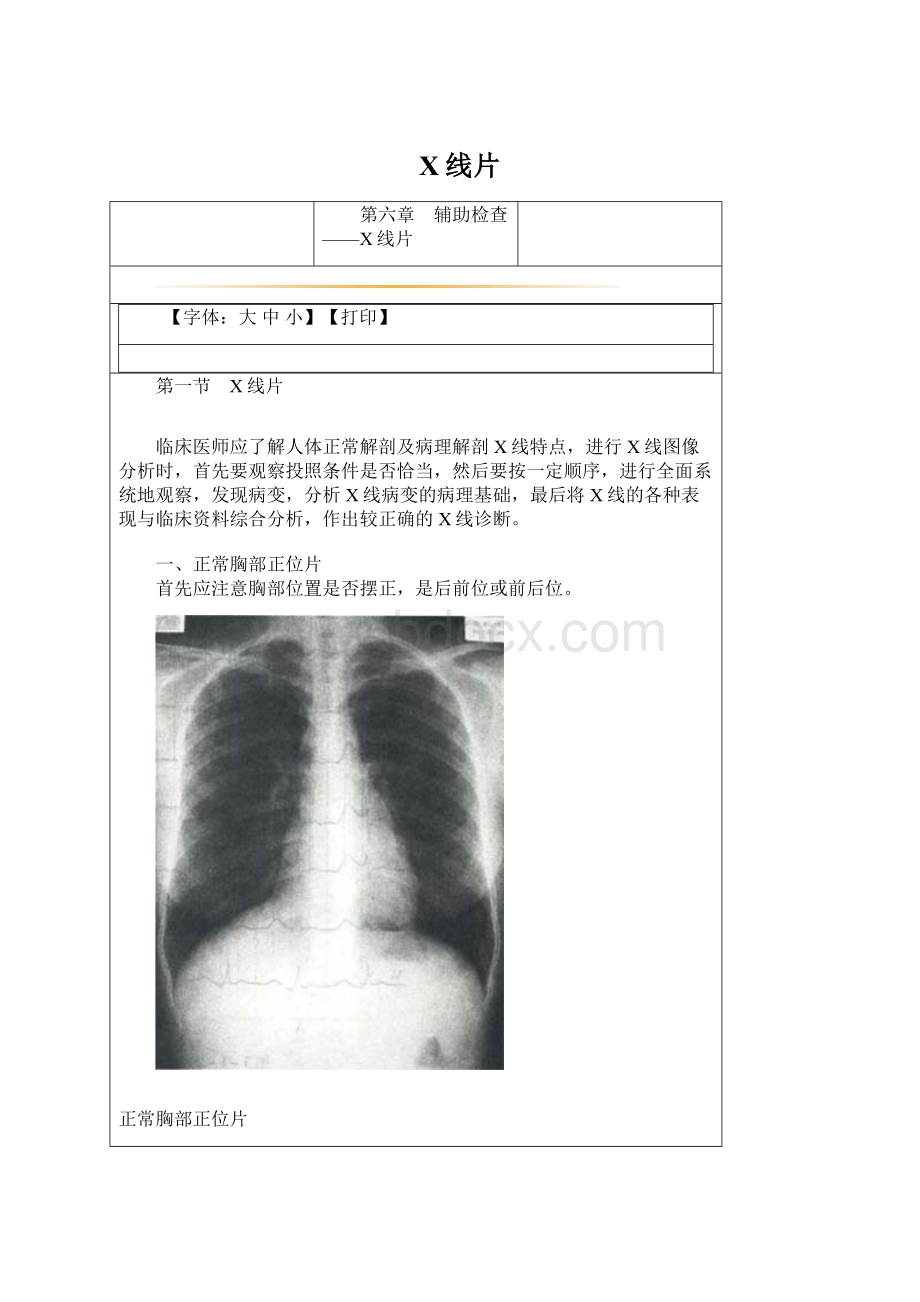 X线片Word格式文档下载.docx