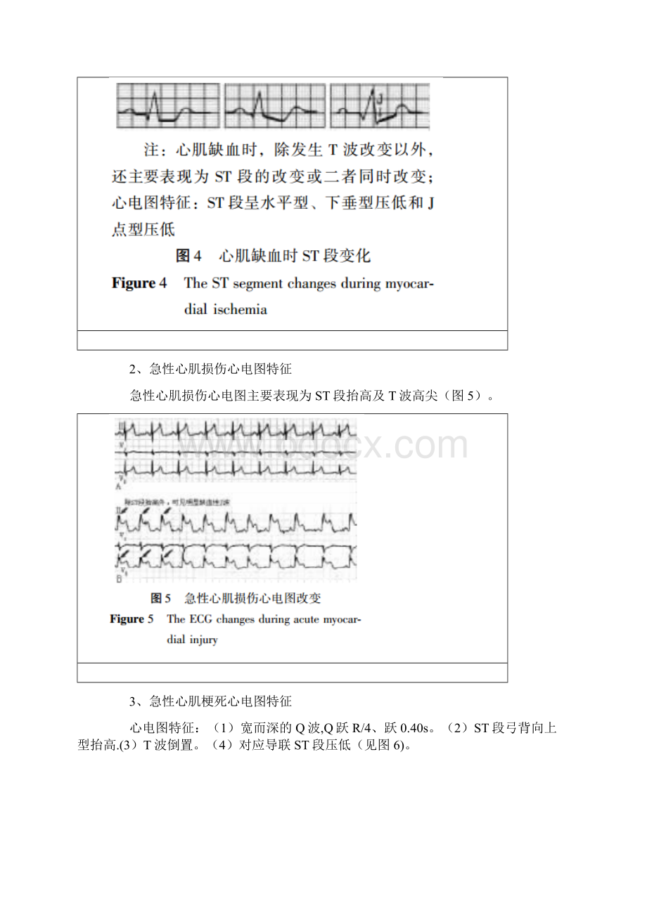 完整详解临床常见心电图危急值识别文档格式.docx_第3页