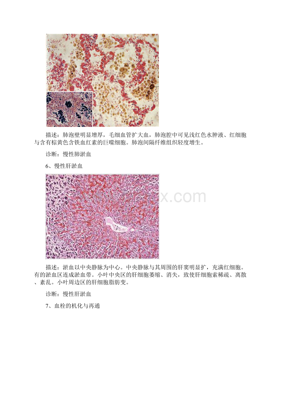 病理切片整理.docx_第3页