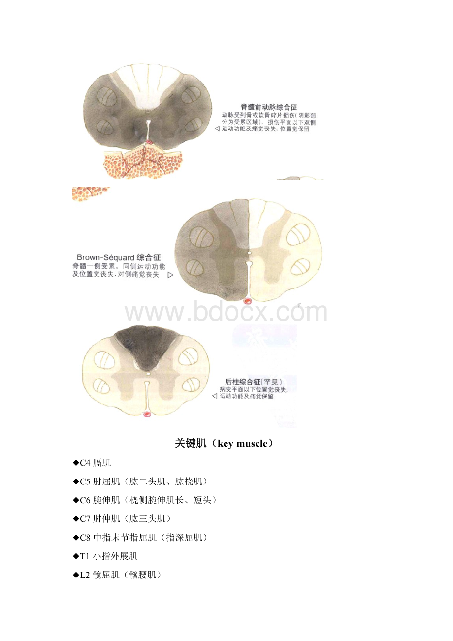 脊髓损伤读书笔记Word文档格式.docx_第2页