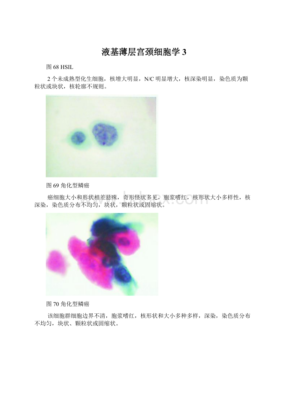 液基薄层宫颈细胞学3.docx