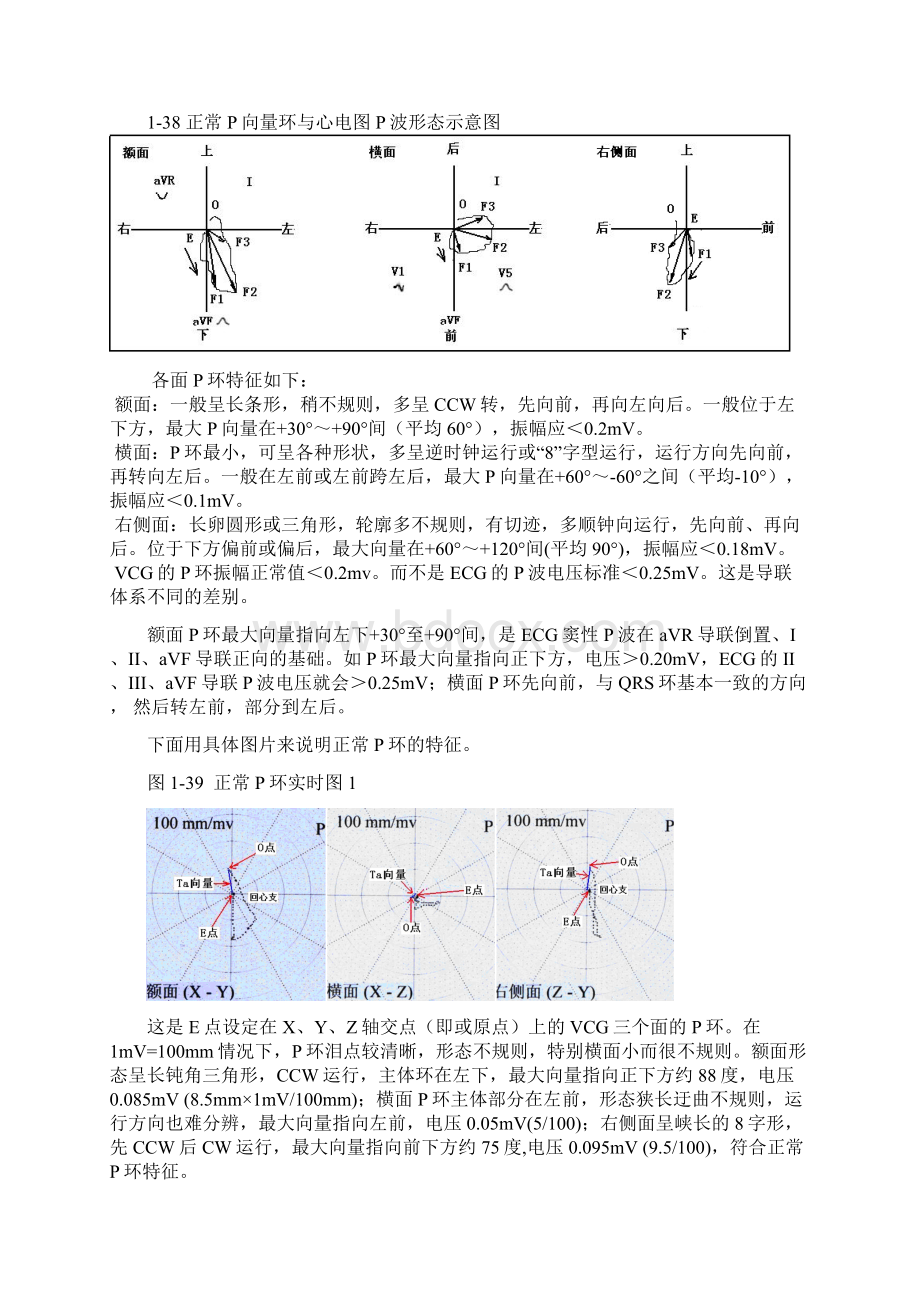 心电向量图VCG诊断资料4第四讲心电向量图PQRST环分析.docx_第2页