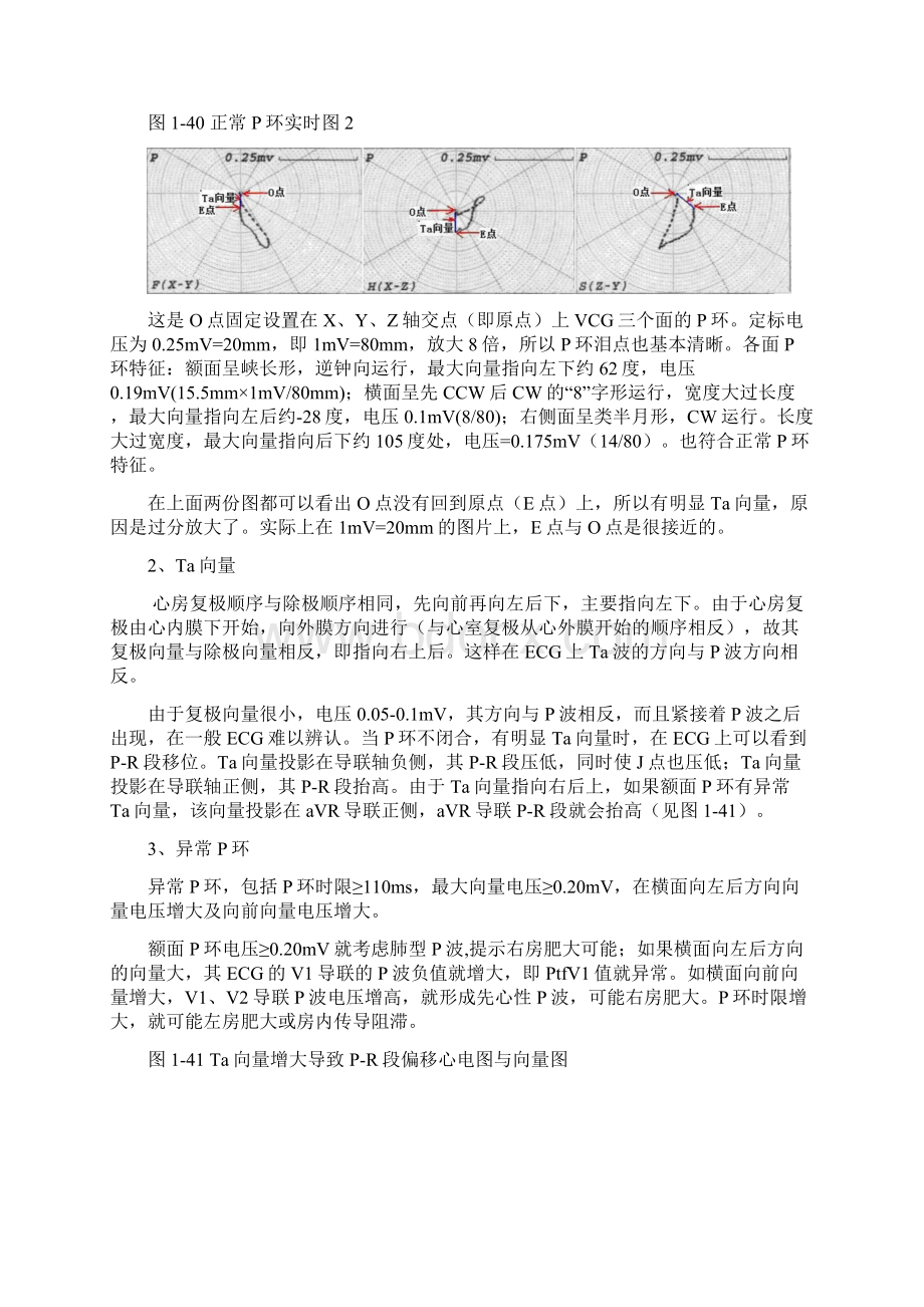 心电向量图VCG诊断资料4第四讲心电向量图PQRST环分析.docx_第3页