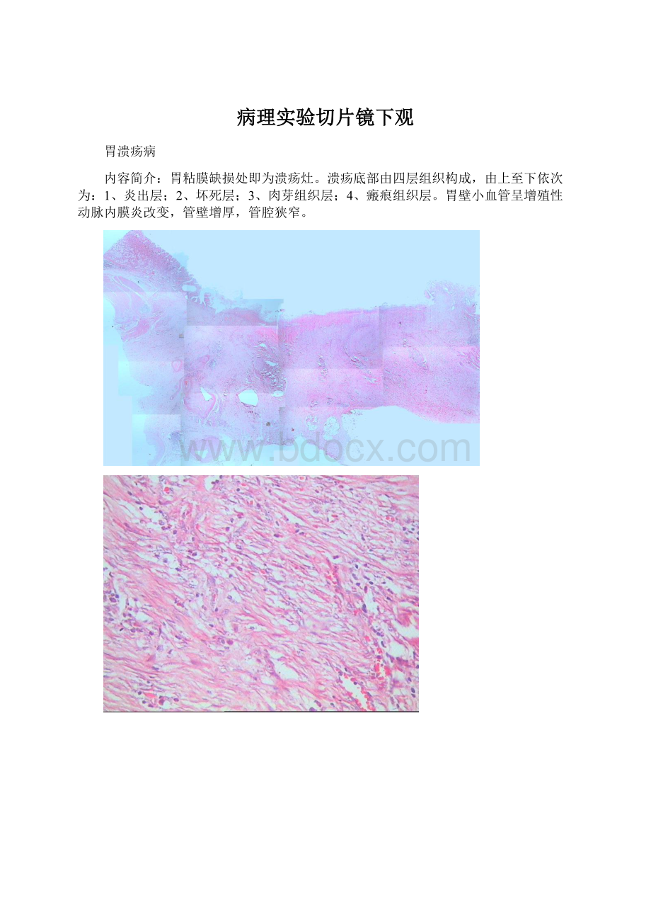 病理实验切片镜下观Word格式文档下载.docx_第1页