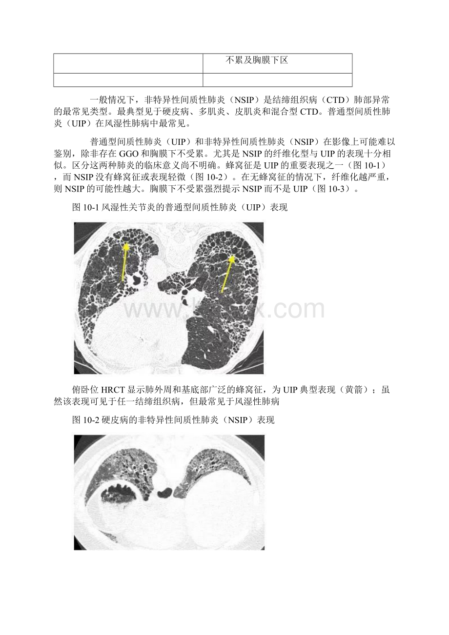 高分辨CT之结缔组织病Word文件下载.docx_第3页