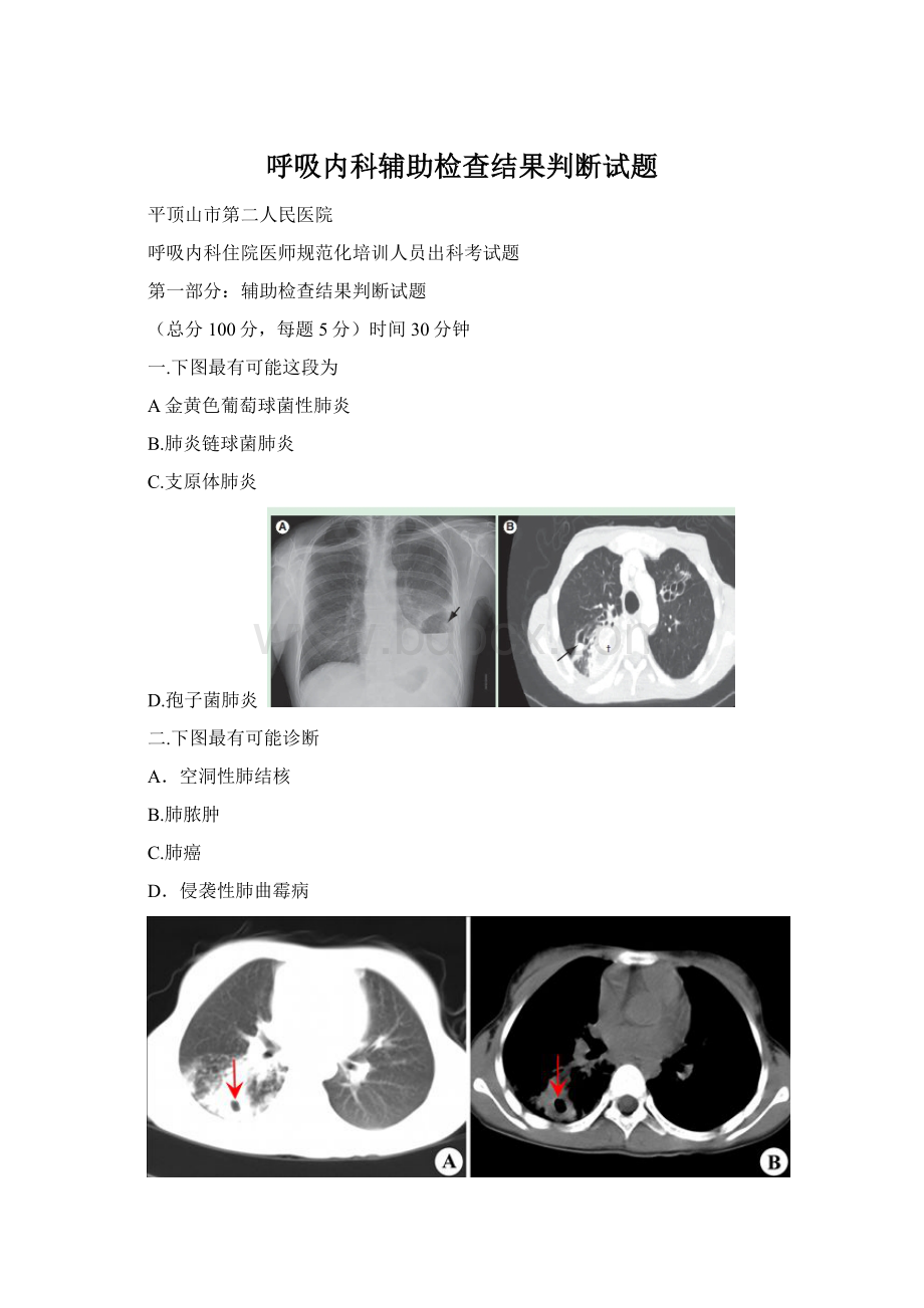 呼吸内科辅助检查结果判断试题.docx