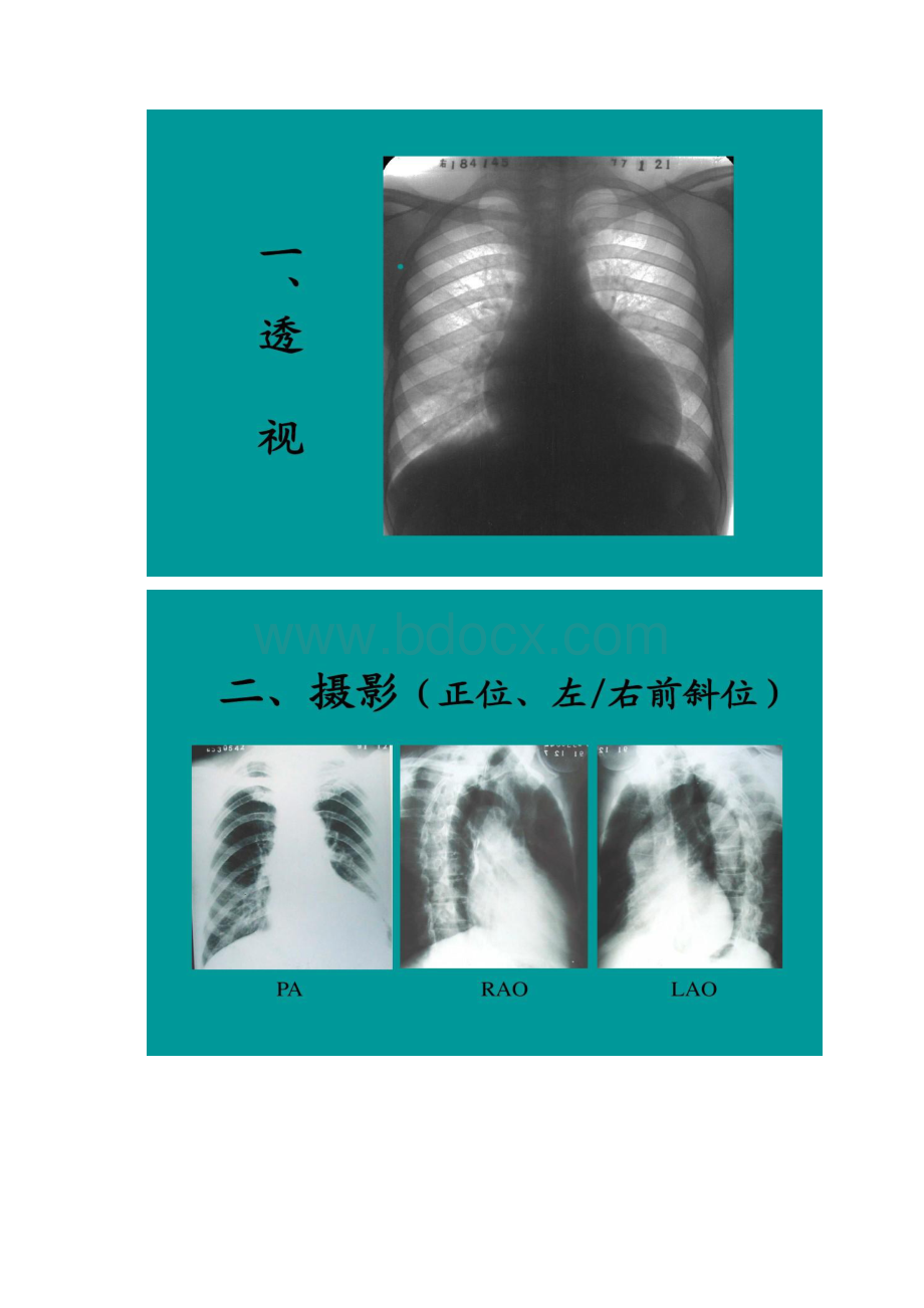 循环系统常见病X线诊断精Word格式文档下载.docx_第2页