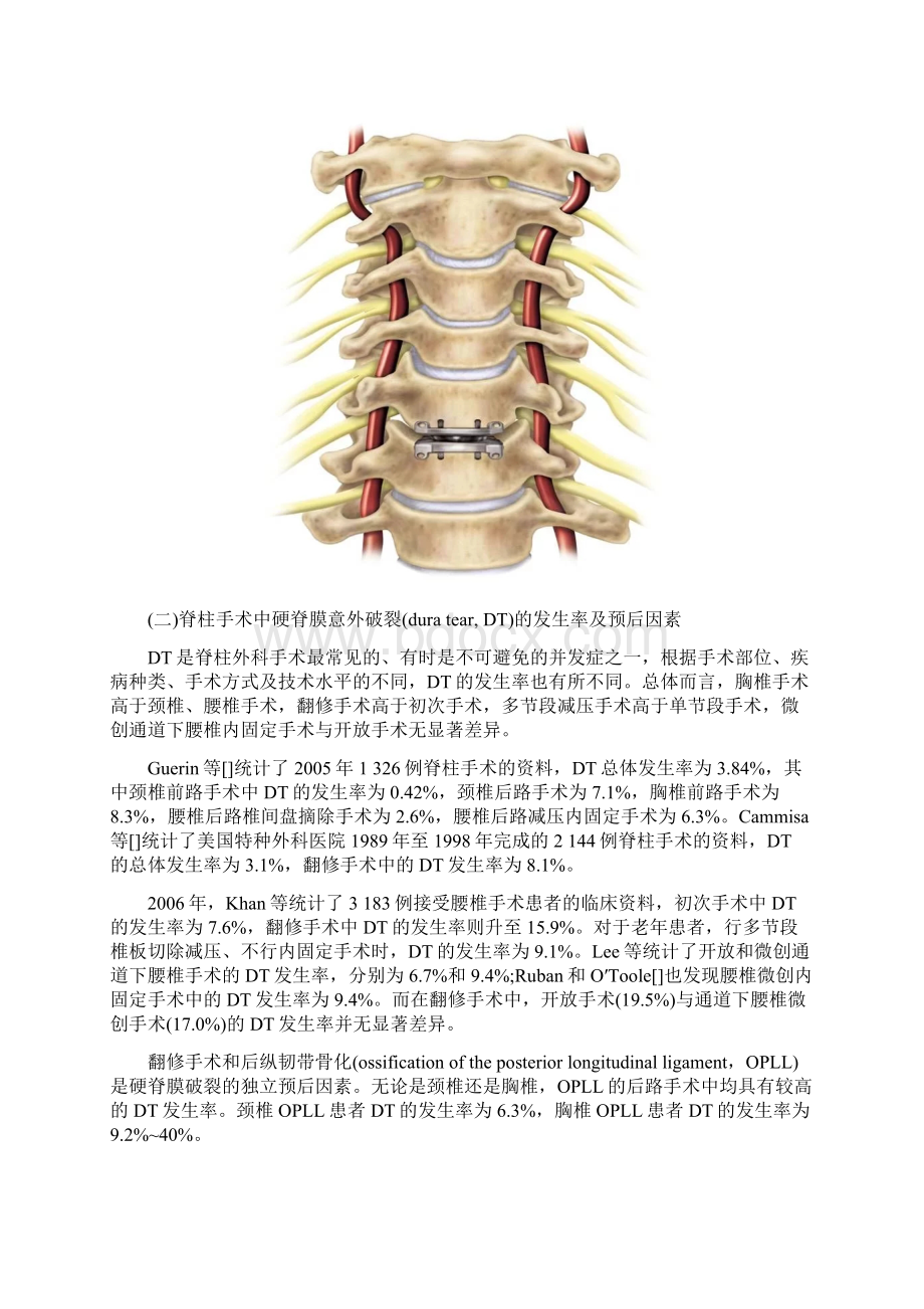 脊柱手术脊膜破裂及术后脑脊液漏的诊疗指南最新版.docx_第2页