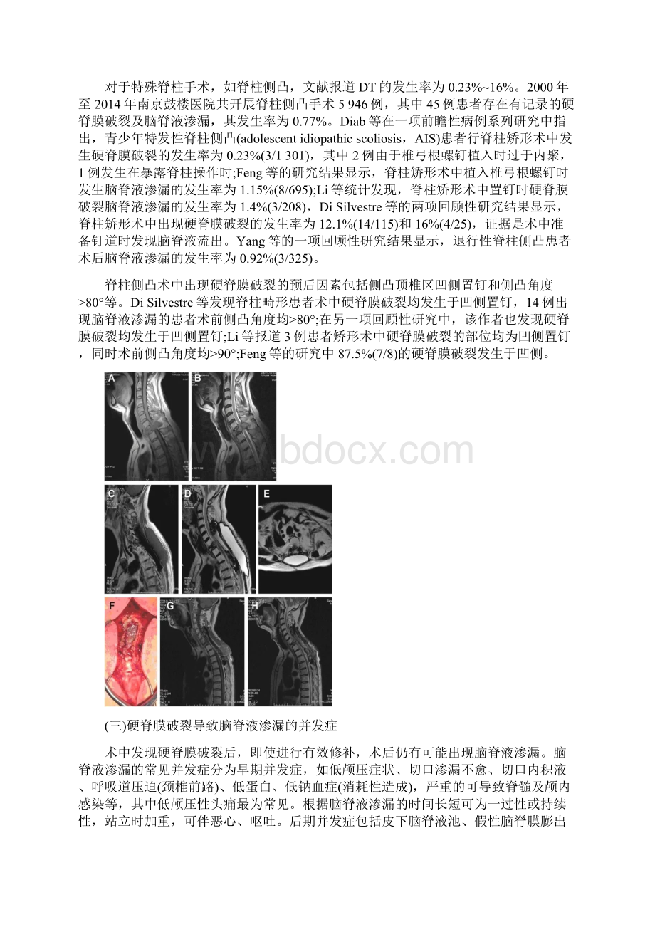 脊柱手术脊膜破裂及术后脑脊液漏的诊疗指南最新版.docx_第3页