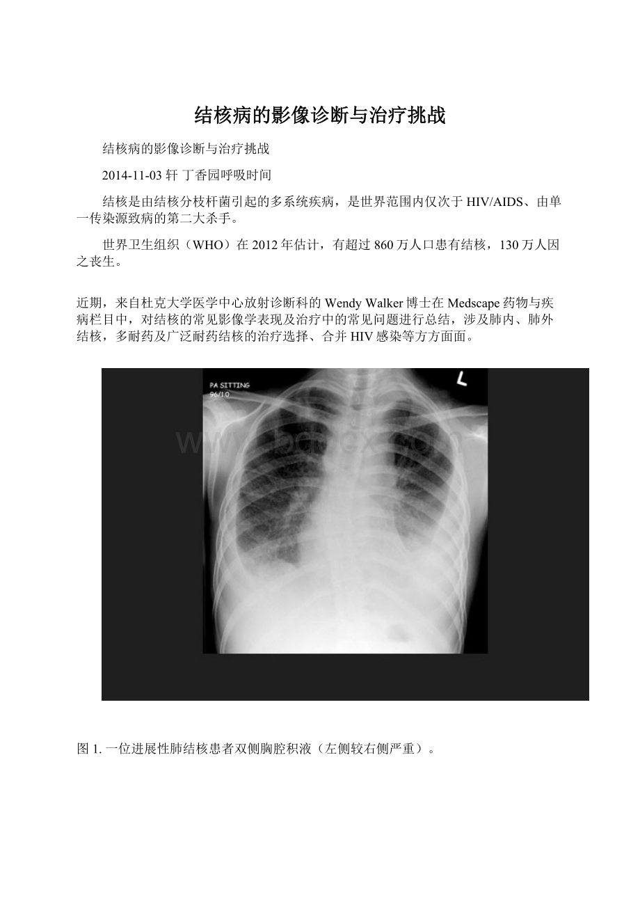 结核病的影像诊断与治疗挑战Word格式.docx