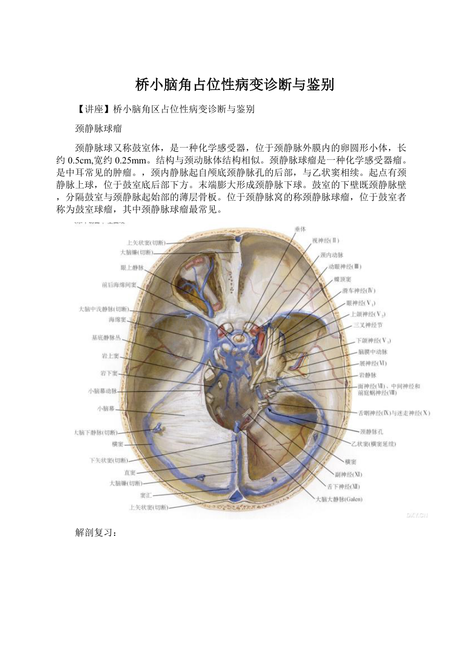 桥小脑角占位性病变诊断与鉴别Word下载.docx