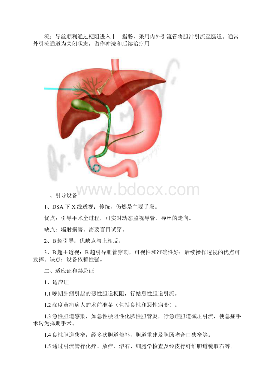 经皮穿刺肝胆管引流术.docx_第3页