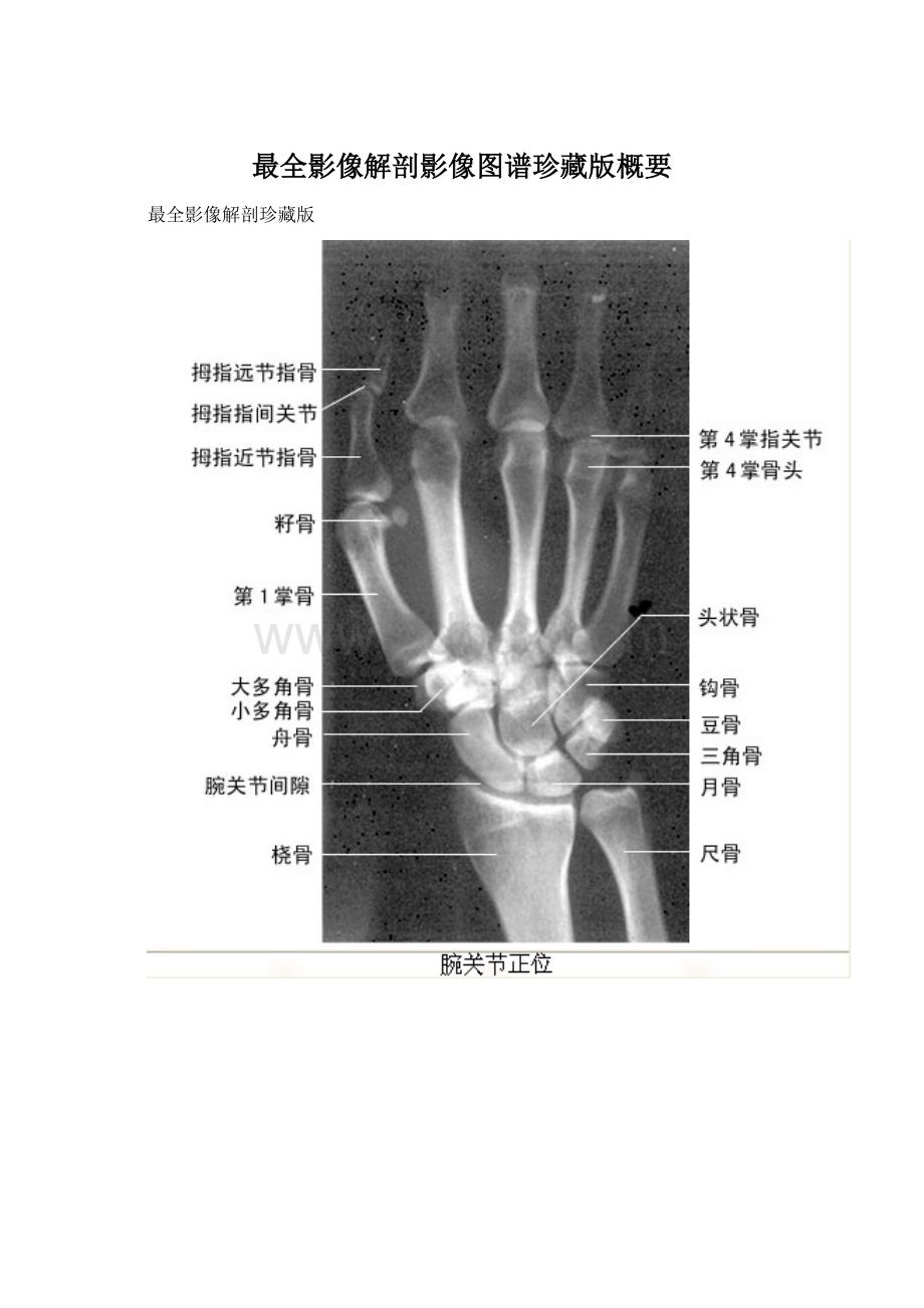 最全影像解剖影像图谱珍藏版概要.docx