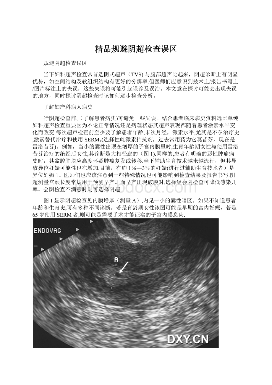 精品规避阴超检查误区.docx_第1页