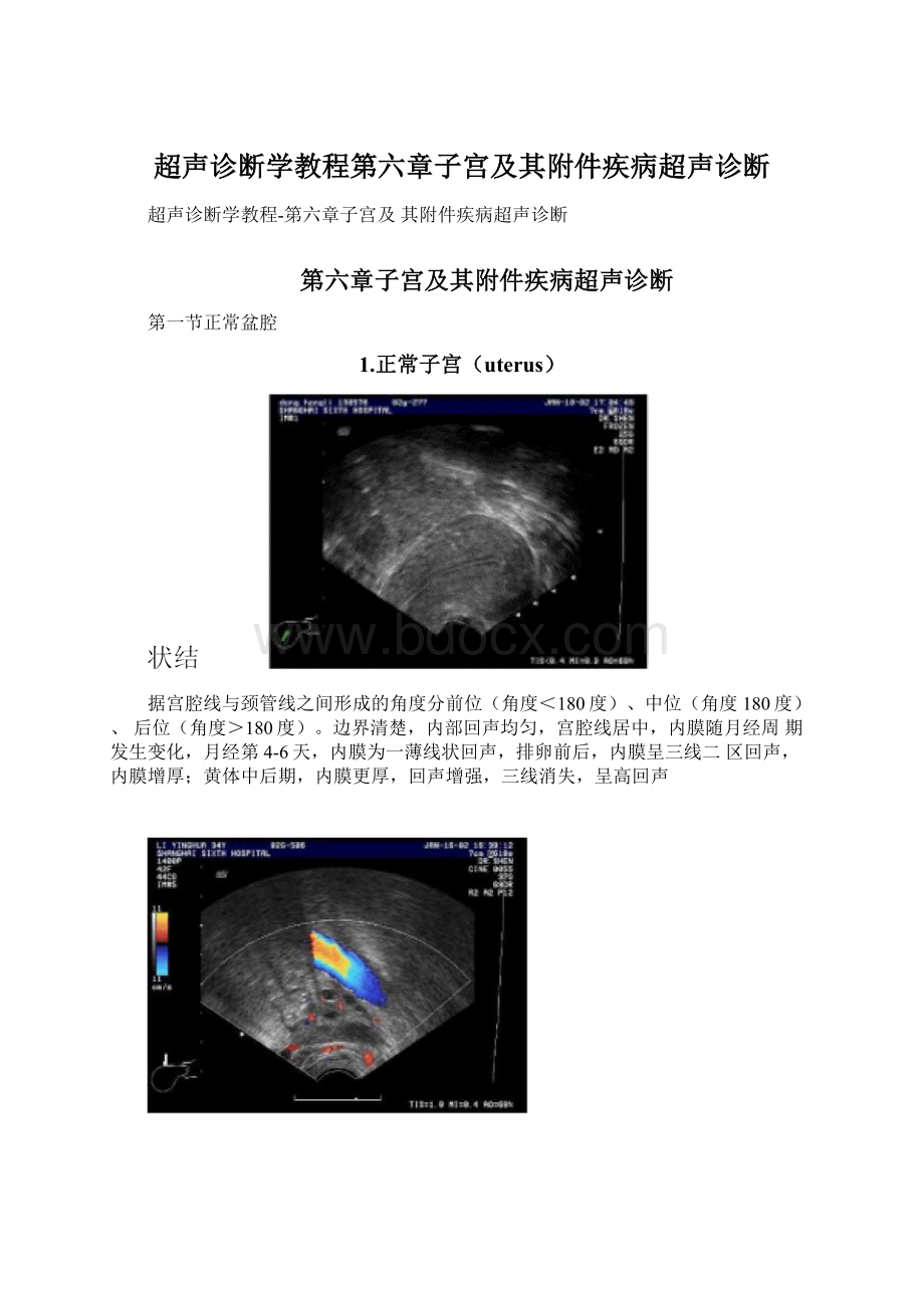 超声诊断学教程第六章子宫及其附件疾病超声诊断.docx