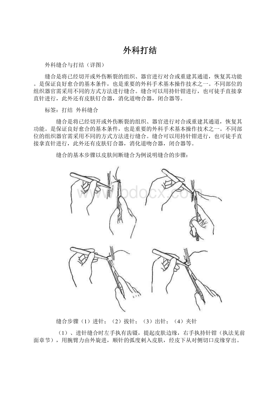 外科打结Word格式文档下载.docx_第1页