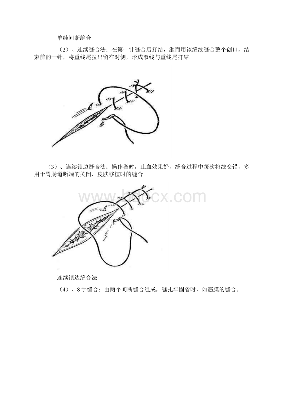 外科打结Word格式文档下载.docx_第3页