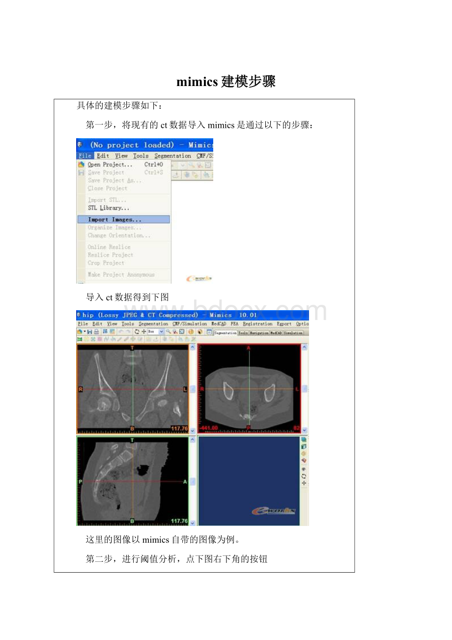 mimics建模步骤.docx