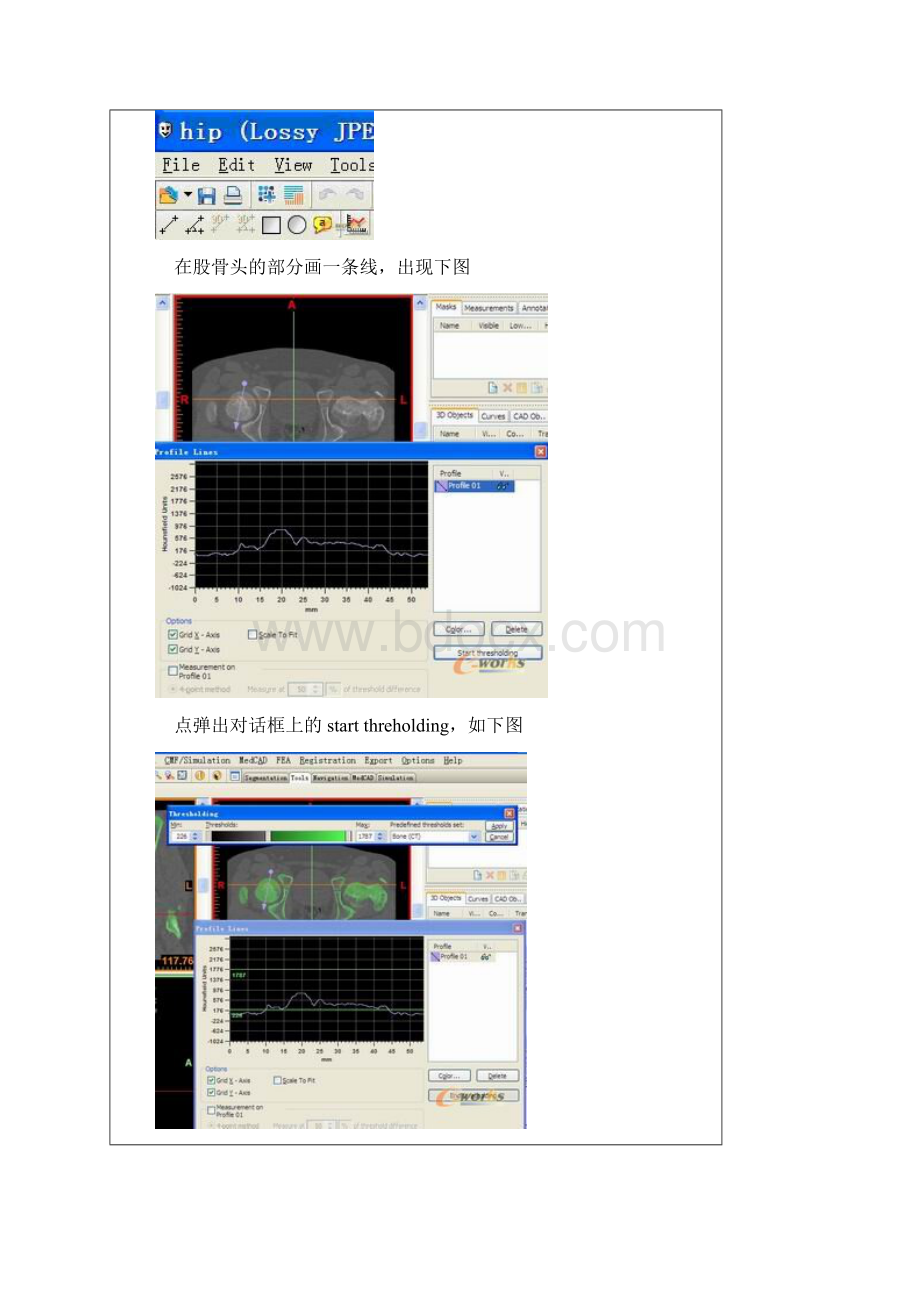 mimics建模步骤.docx_第2页