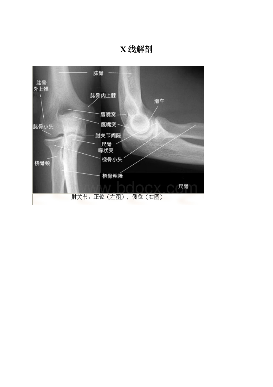 X线解剖Word文档格式.docx_第1页