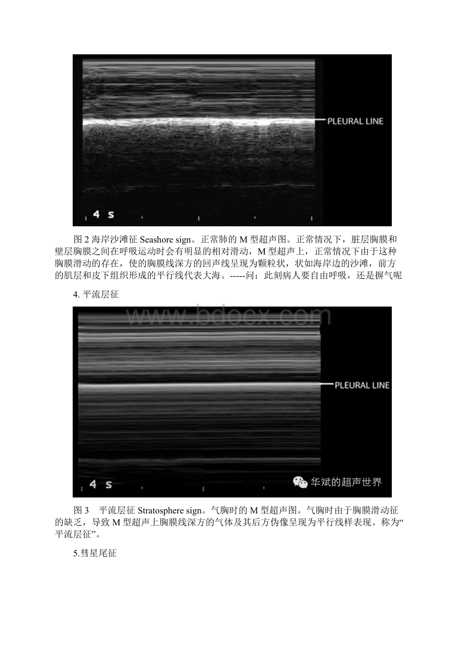 肺部超声一些常见形象征象的解释.docx_第2页