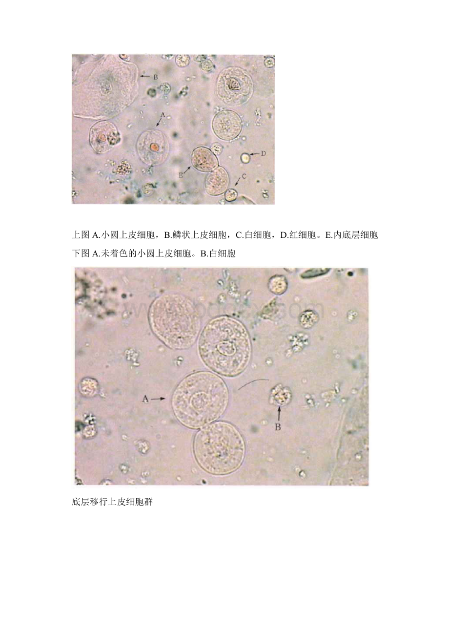 尿沉渣图谱第二册参考资料.docx_第2页