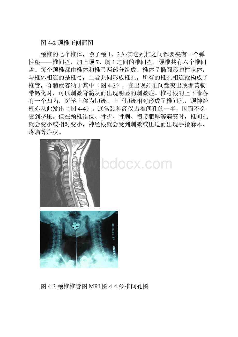 1颈椎病图文混合版.docx_第2页