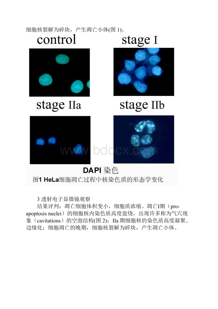 整理细胞凋亡的检测含图片陈英玉.docx_第2页