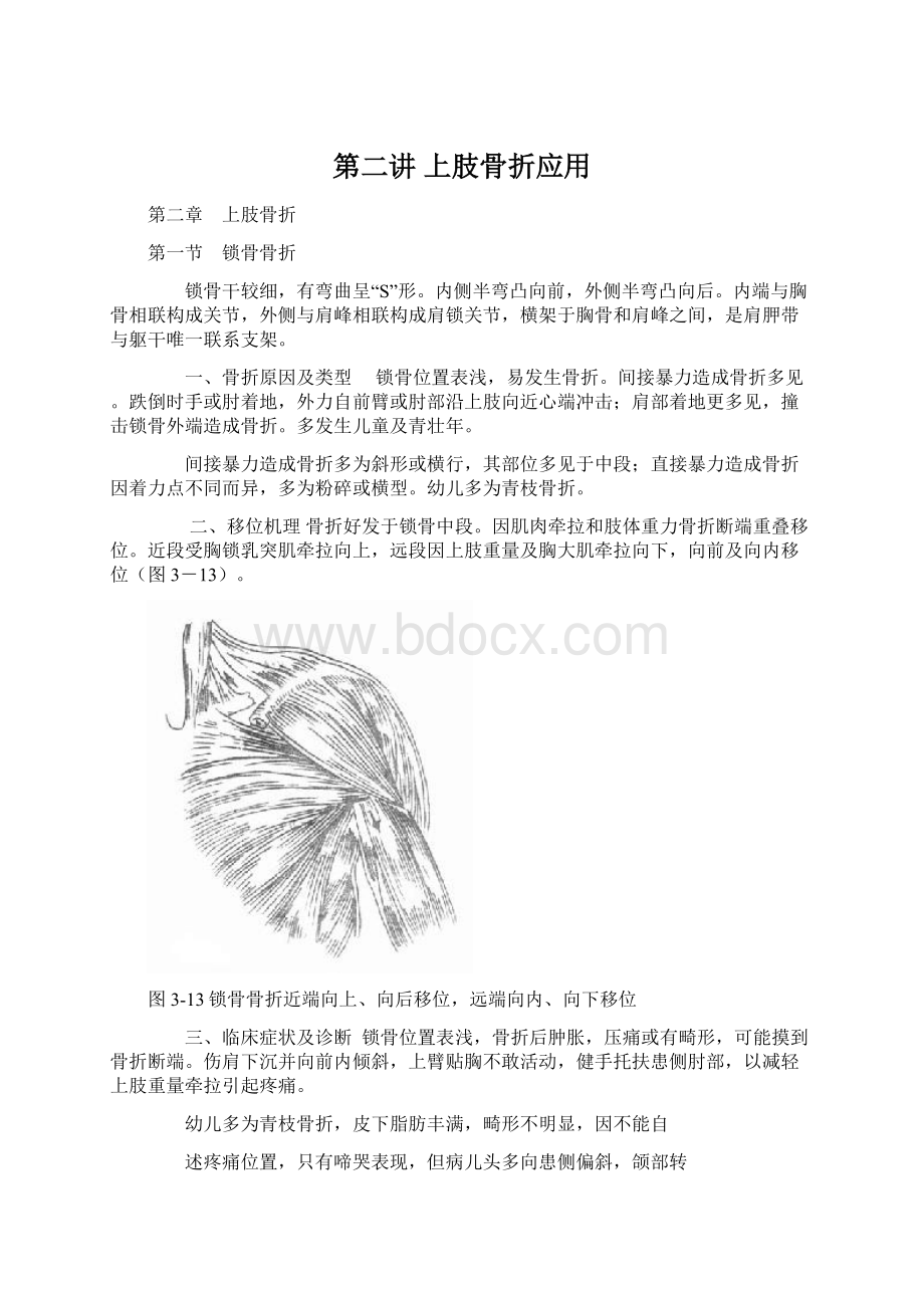 第二讲 上肢骨折应用.docx_第1页