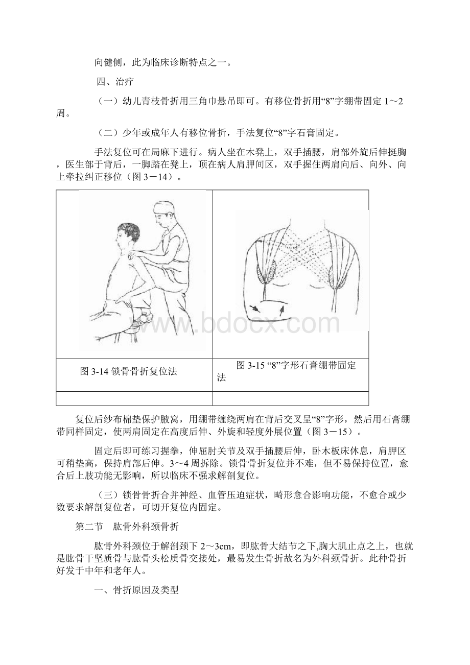 第二讲 上肢骨折应用.docx_第2页