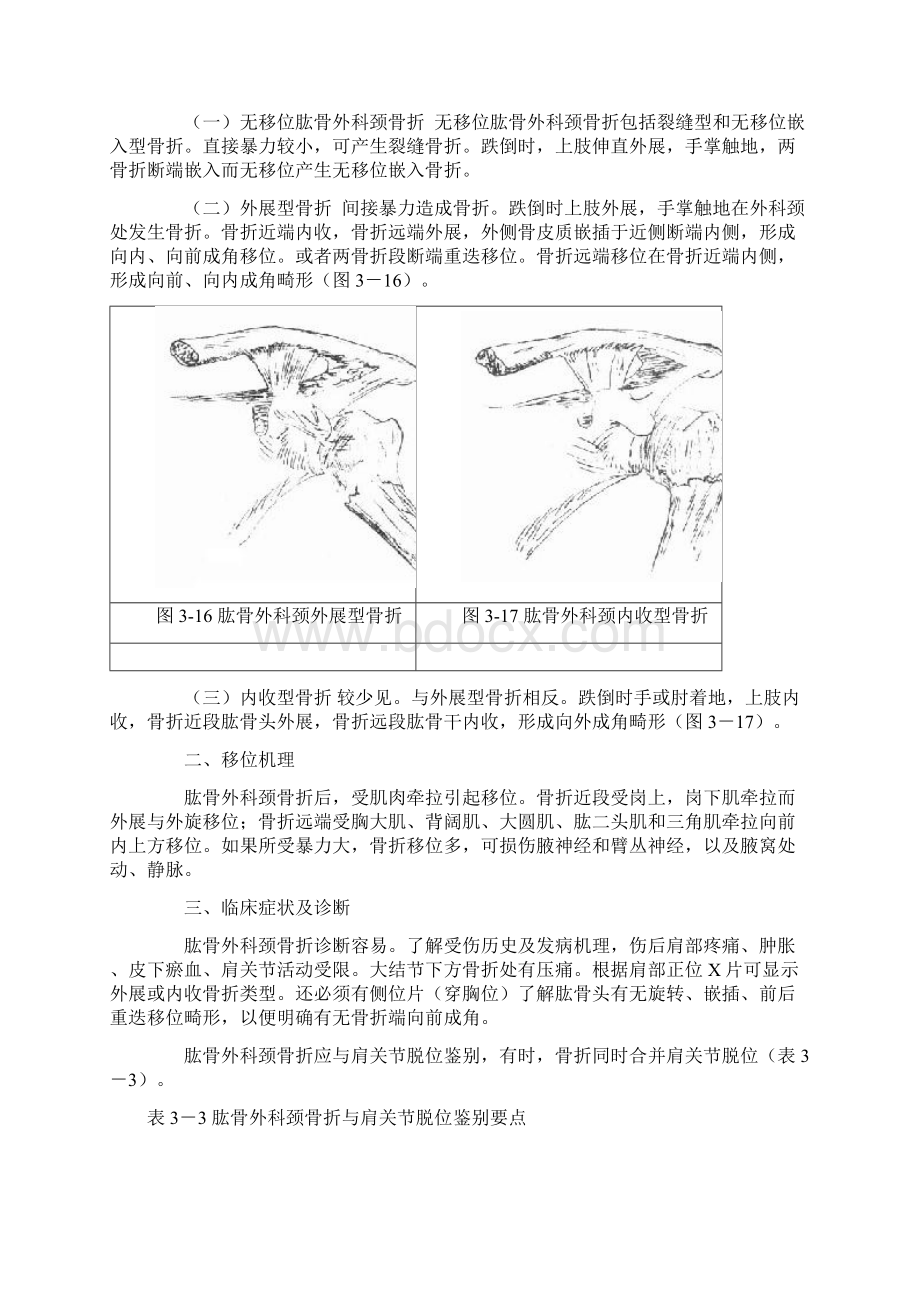 第二讲 上肢骨折应用.docx_第3页