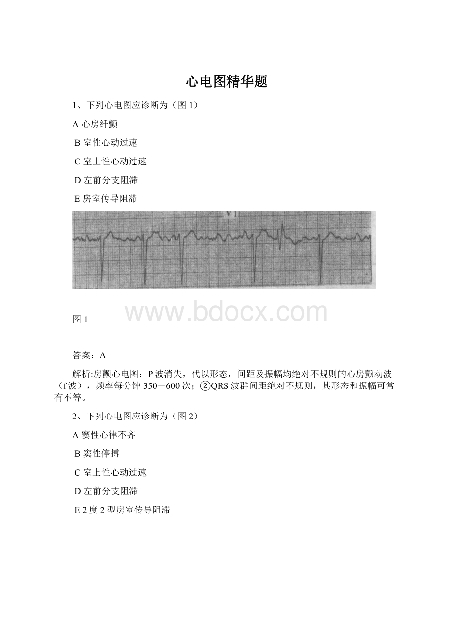 心电图精华题.docx