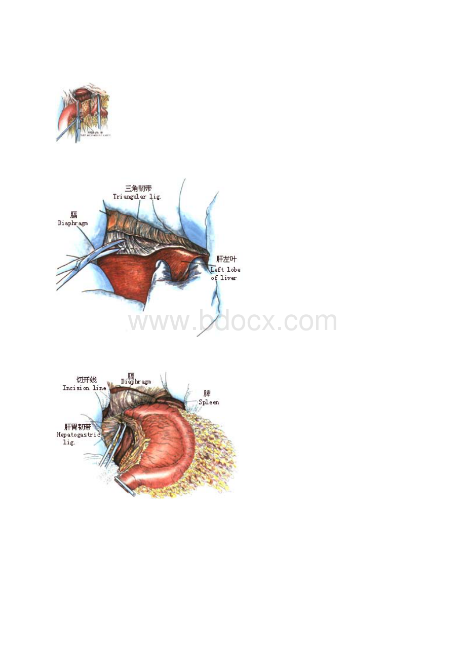 胃全切除术图谱Word文档下载推荐.docx_第3页
