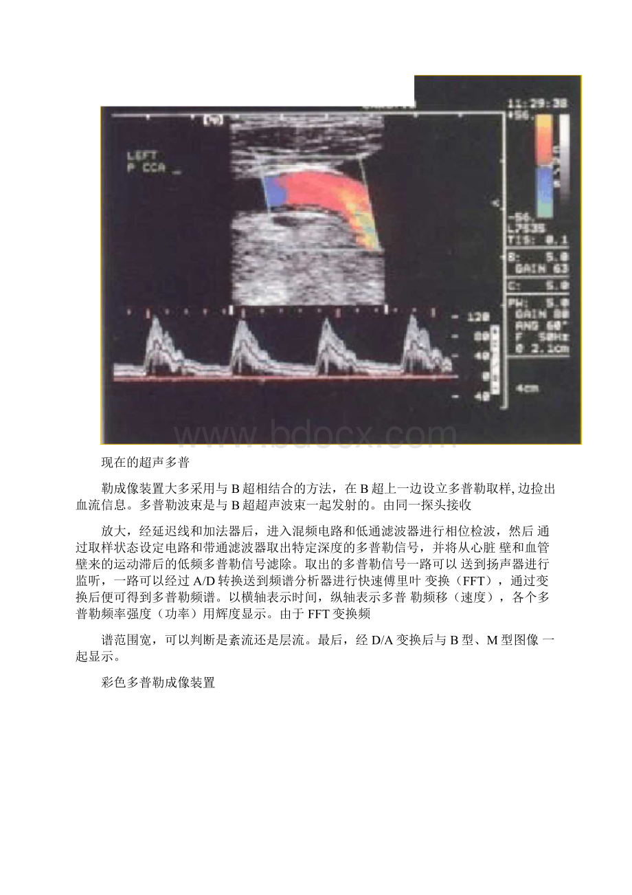 超声多普勒成像原理.docx_第2页