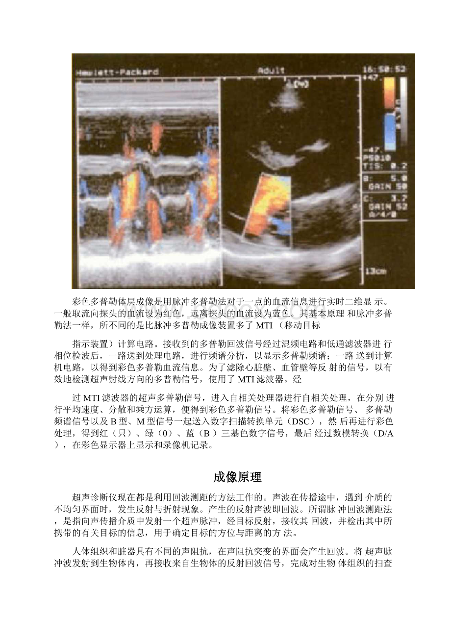 超声多普勒成像原理.docx_第3页