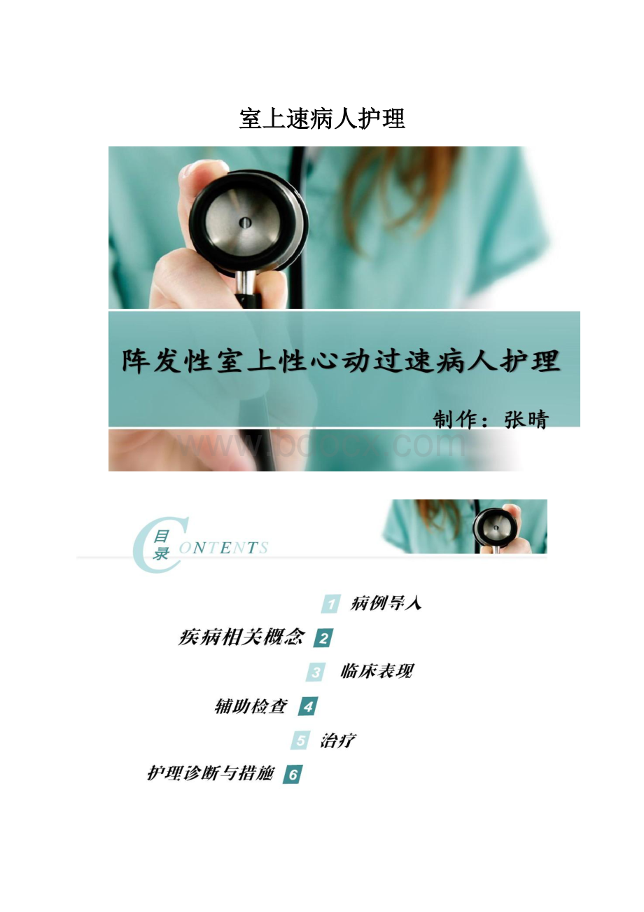 室上速病人护理Word格式文档下载.docx