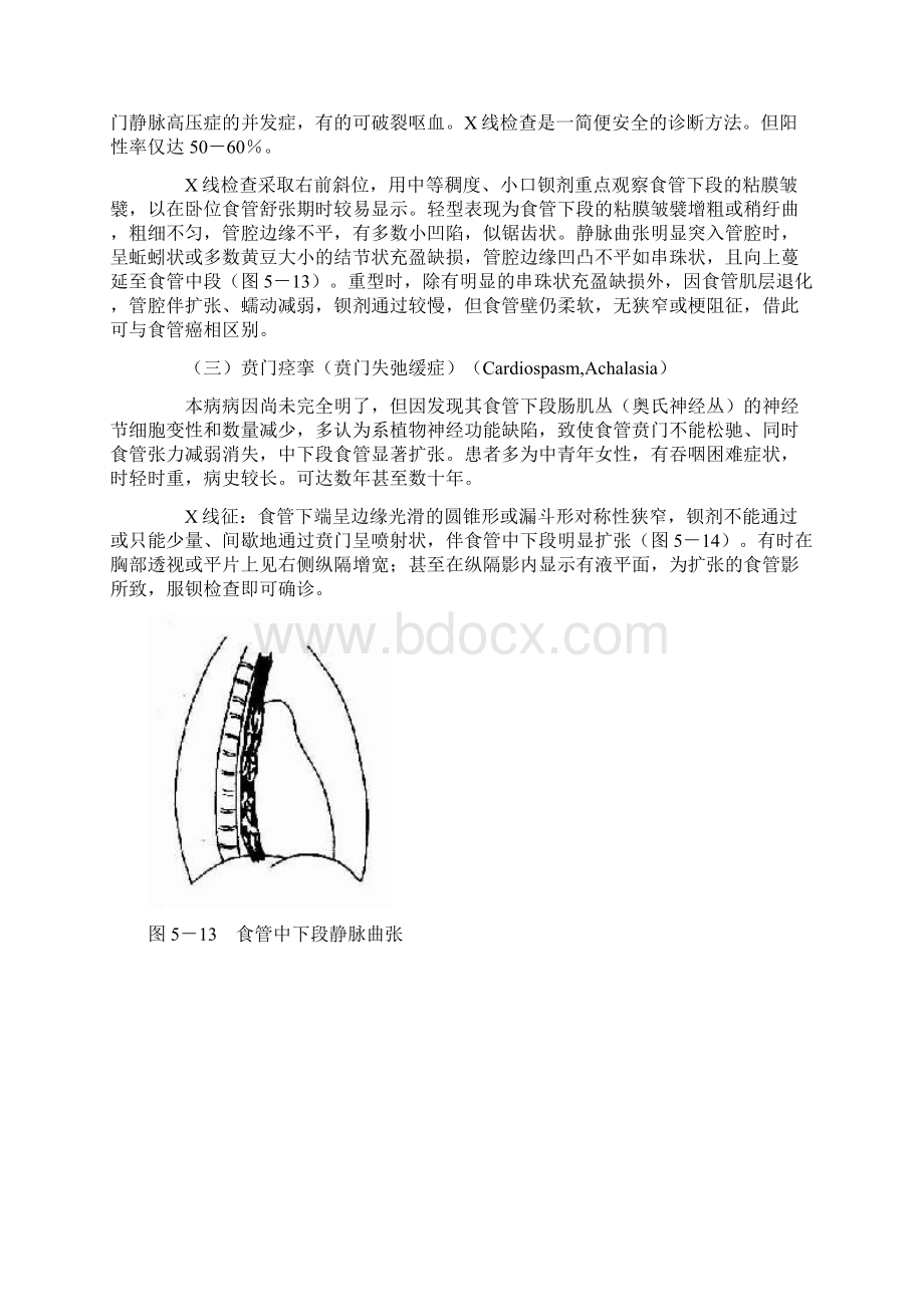 第四讲胃肠道常见疾病.docx_第2页