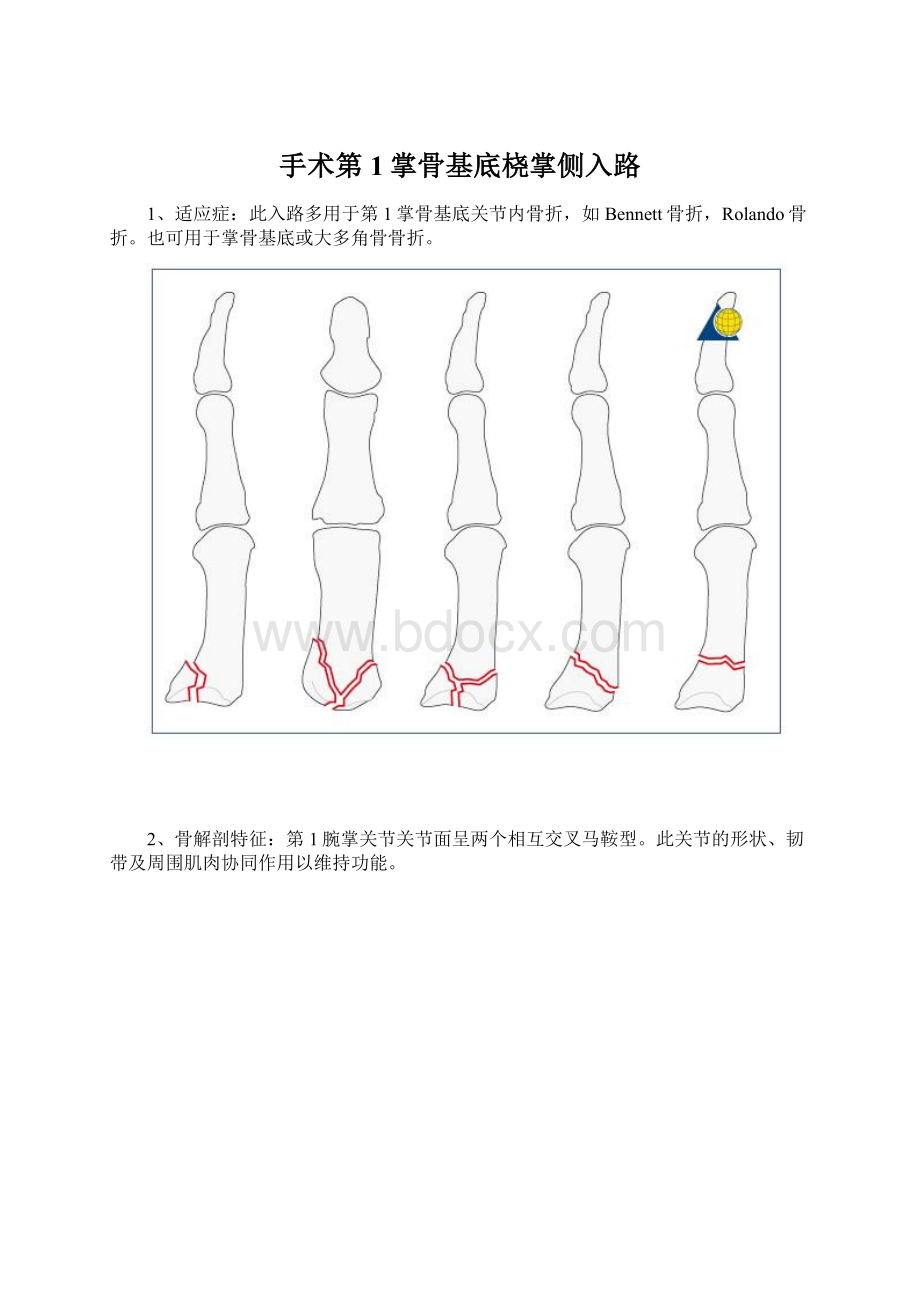 手术第1掌骨基底桡掌侧入路Word文件下载.docx_第1页