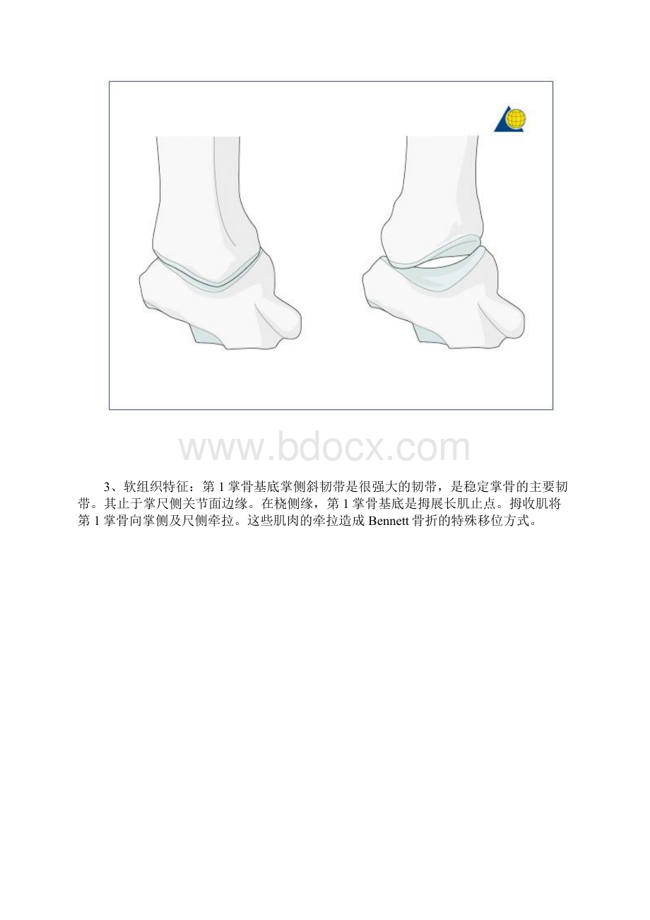 手术第1掌骨基底桡掌侧入路Word文件下载.docx_第2页