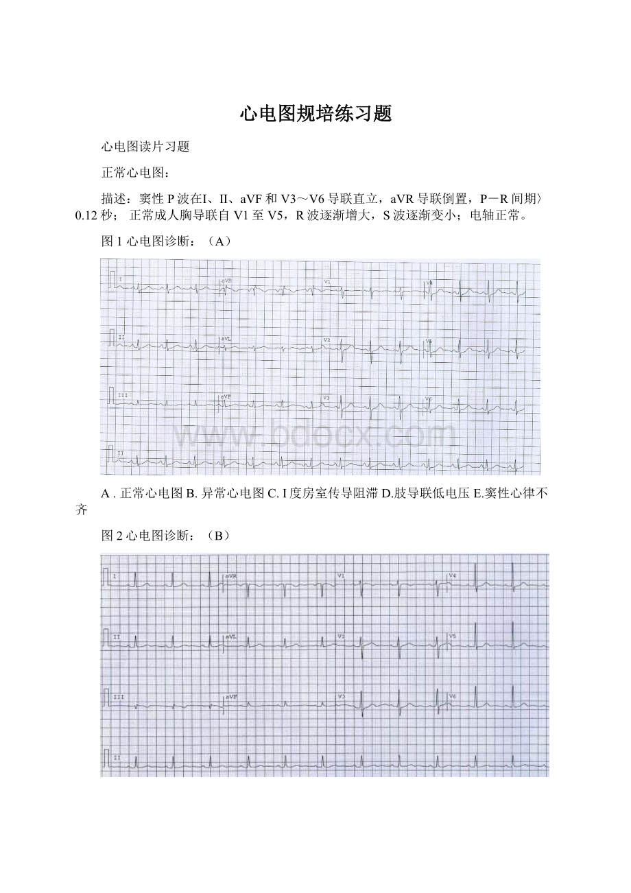 心电图规培练习题.docx_第1页