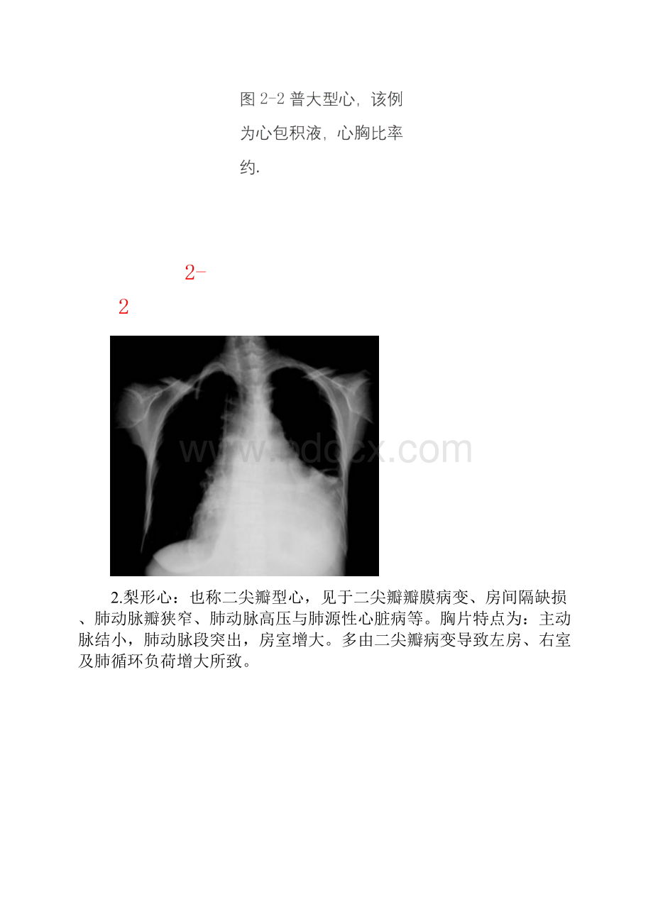 常见的线胸片.docx_第3页