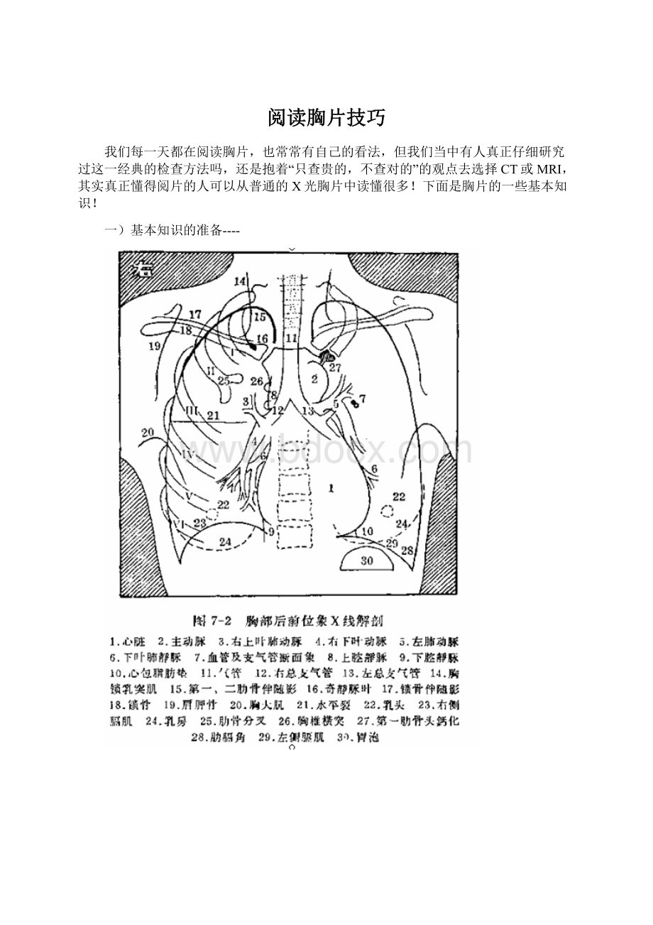 阅读胸片技巧Word格式文档下载.docx_第1页