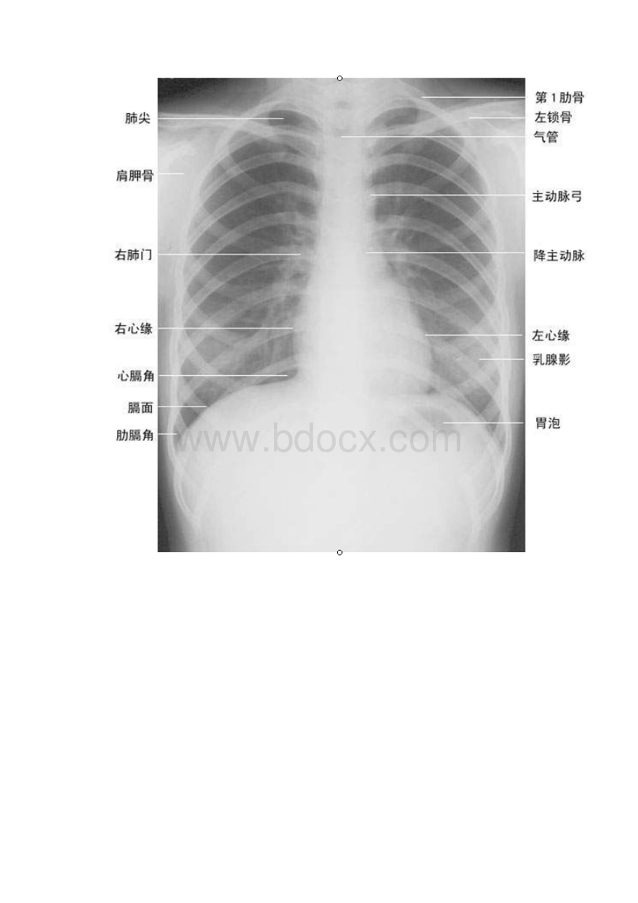 阅读胸片技巧Word格式文档下载.docx_第2页