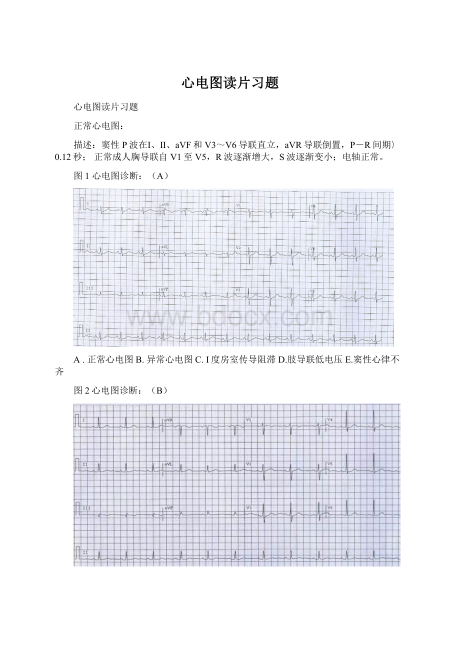 心电图读片习题.docx