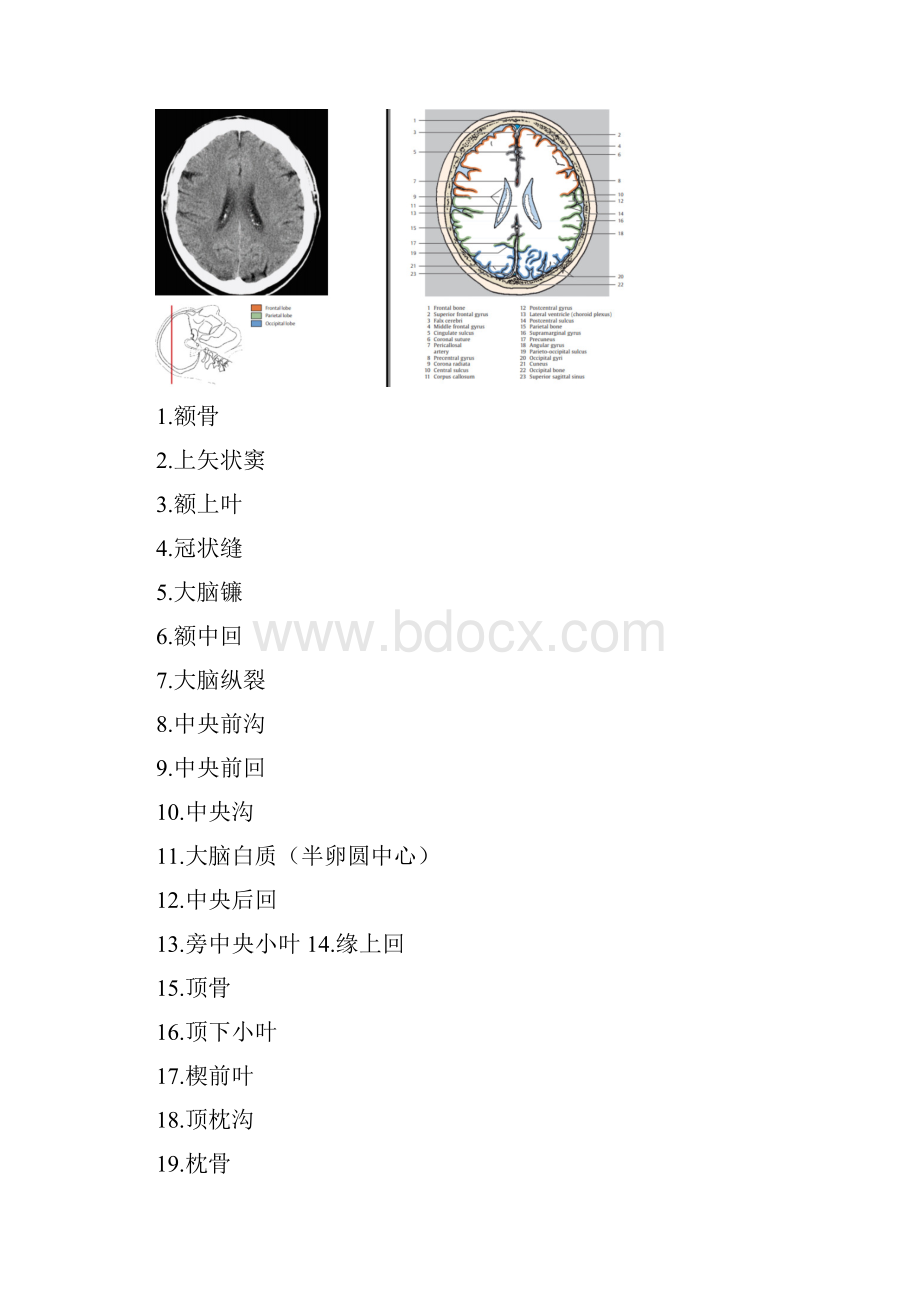 颅脑CT对照图谱Word下载.docx_第2页