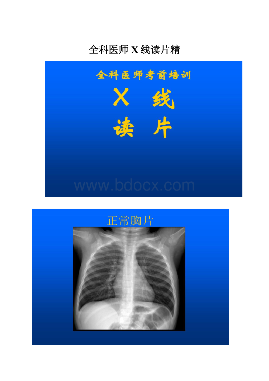 全科医师X线读片精.docx